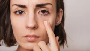 Pink-Eyes-Sore-Eye-1024x576 Woman touching eye with bloodshot conjunctiva.