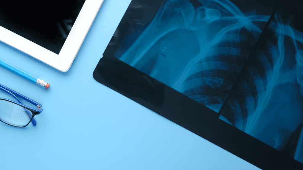 X-ray on desk with tablet and glasses.