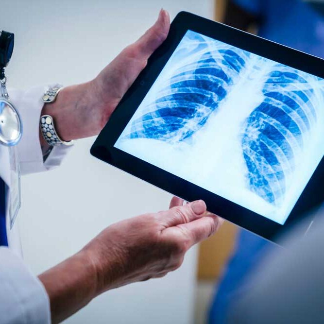 Doctor reviewing chest x-ray on tablet.