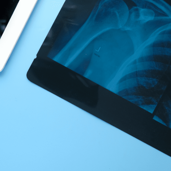 Does Urgent Care Do X-rays